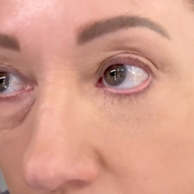 3. Wait 10-15 Minutes